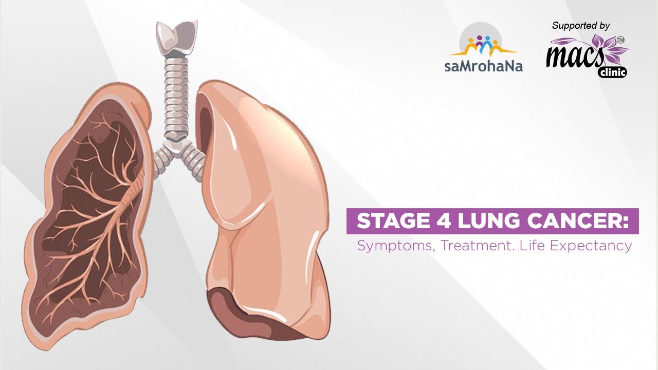 stage 4 lung cancer complete remission