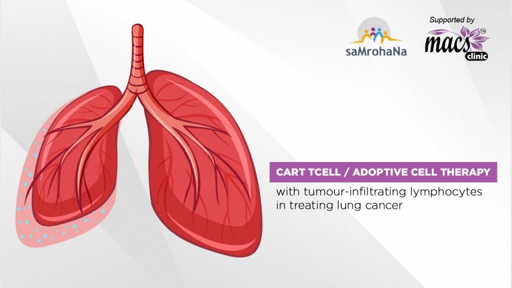 stage-4-lung-cancer-treatment-samrohana