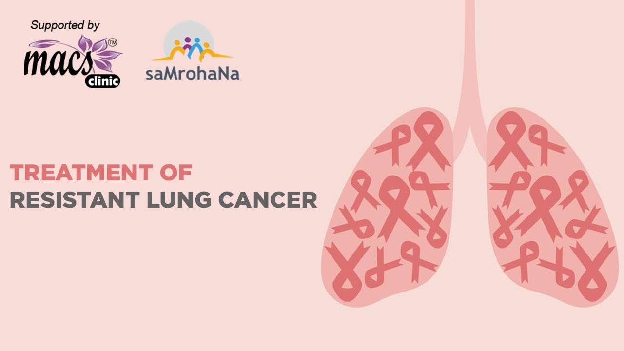 lung cancer stage 4 no treatment