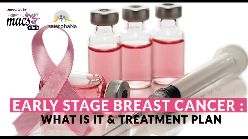 Breast Cancer Treatment Overview SamRohana